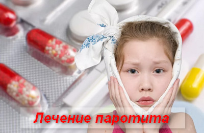 лечение паротита