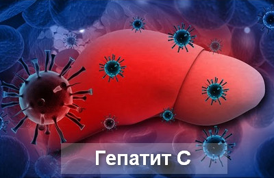 гепатит С
