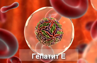 гепатит Е