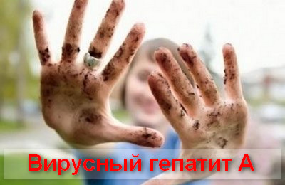 вирусный гепатит А