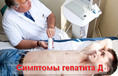 симптомы гепатита Д