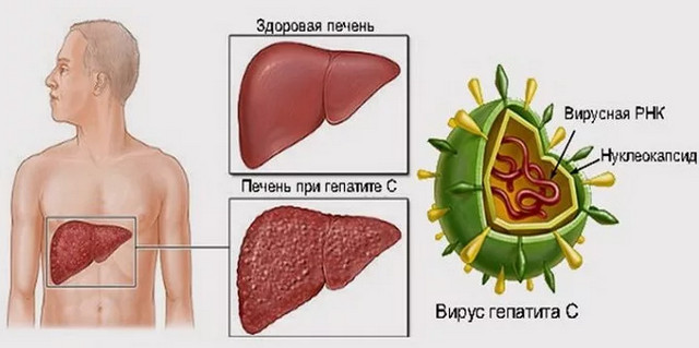 особенности гепатита С