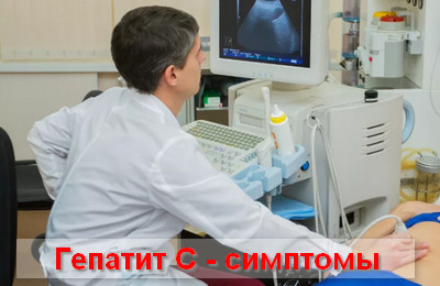 гепатит С - симптомы