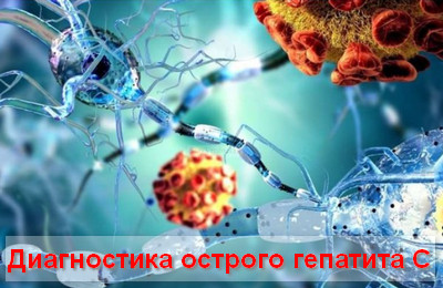 диагностика острого гепатита С
