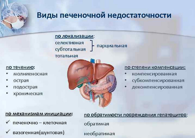 печеночная недостаточность классификация