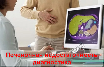 печеночная недостаточность диагностика
