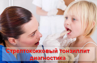стрептококковый тонзиллит диагностика
