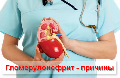 гломерулонефрит - причины