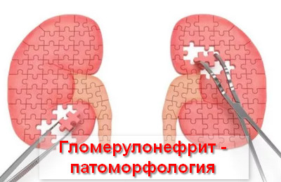гломерулонефрит - патоморфология