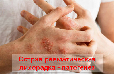 патогенез ОРЛ