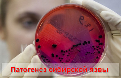 патогенез сибирской язвы