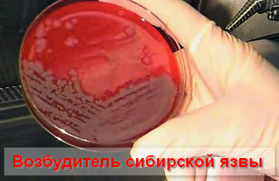 возбудитель сибирской вы