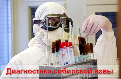 диагностика сибирской язвы