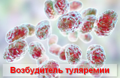 возбудитель туляремии