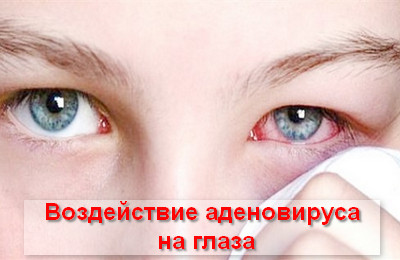 воздействие аденовируса на глаза