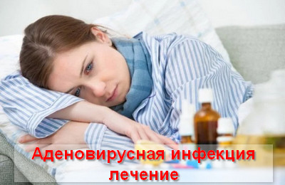 лечение аденовирусной инфекции
