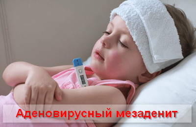 аденовирусный мезаденит