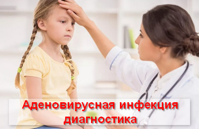 диагностика аденовирусной инфекции