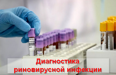 диагностика риновирусной инфекции