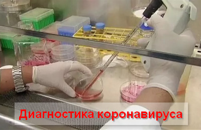 диагностика коронавируса