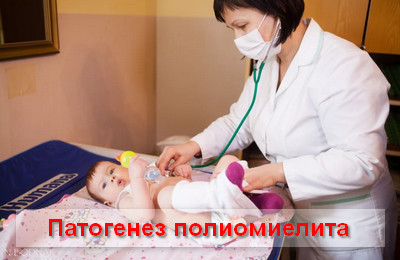 патогенез полиомиелит