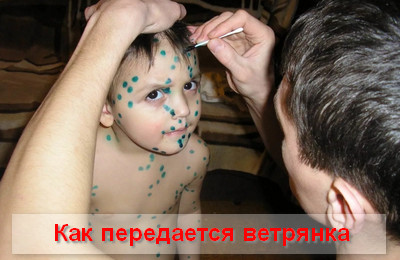 как передается ветрянка