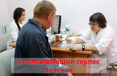 опоясывающий герпес лечение