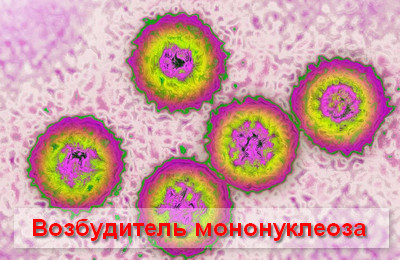 возбудитель мононуклеоза