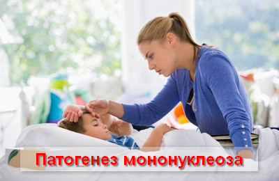 патогенез мононуклеоза