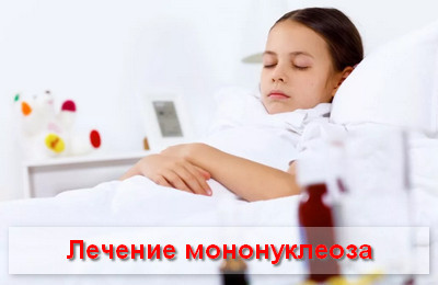 лечение мононуклеоза