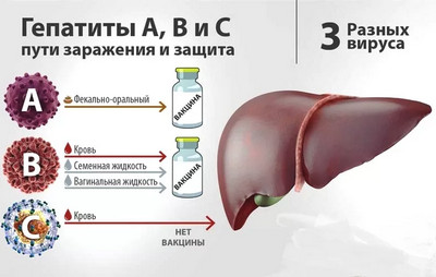 лечение гепатитов средней и тяжелой тяжести