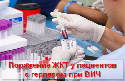 поражение ЖКТ у пациентов с герпесом при ВИЧ