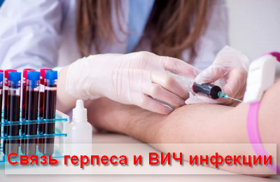 связь герпеса и ВИЧ инфекции