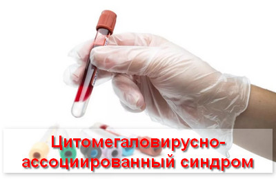 цитомегаловирусно-ассоциированный синдром