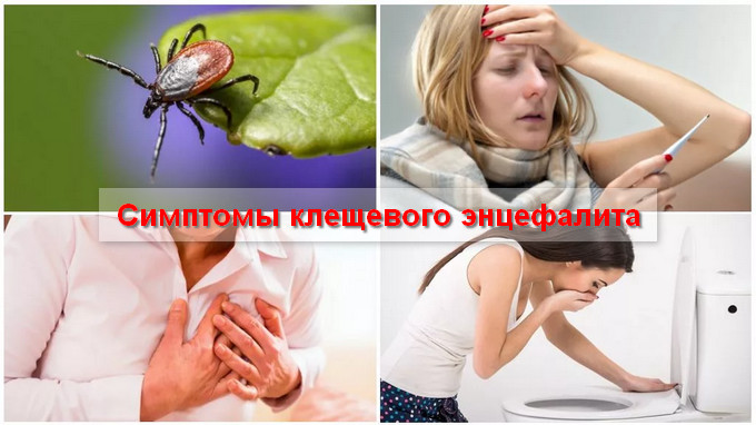 клещевой энцефалит симптомы