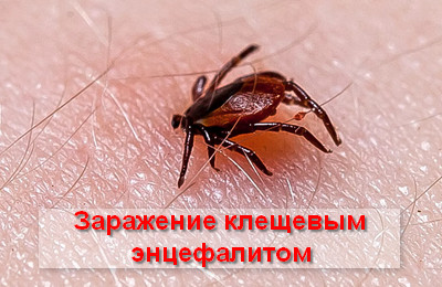 заражение клещевым энцефалитом