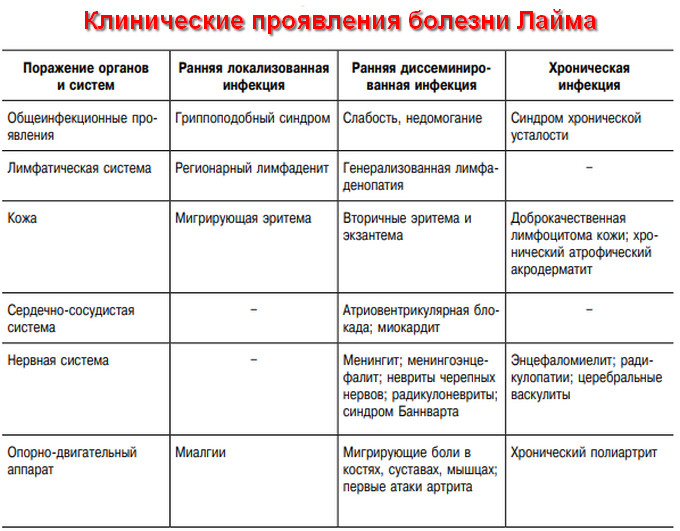 клещевой боррелиоз симптомы и лечение