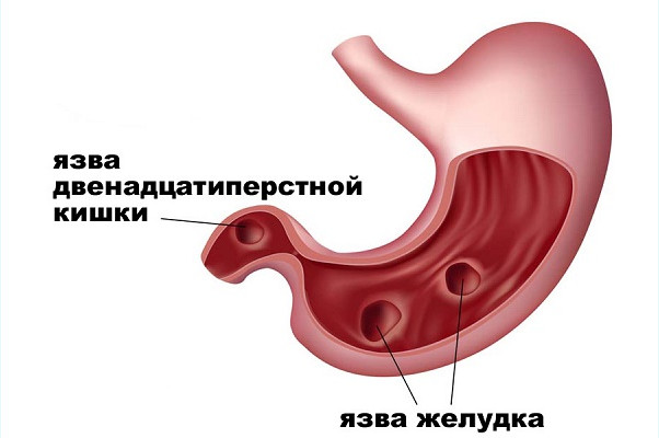 классификация