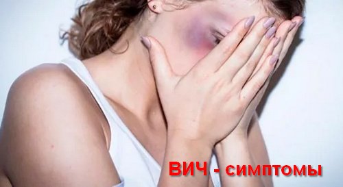 ВИЧ - симптомы