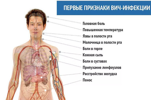бессимптомная стадия ВИЧ