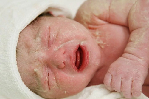 Как передается кандидоз кожи