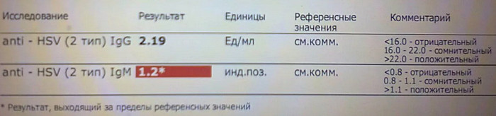 ВПГ 2