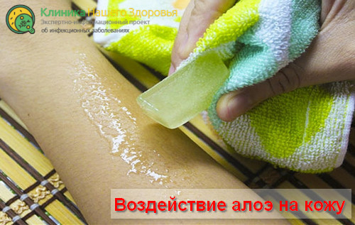 Воздействие алоэ на кожу, поражённую высыпаниями