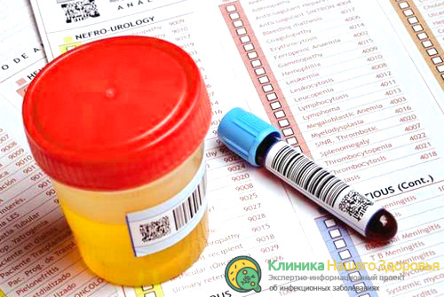 диагностика внутреннего герпеса
