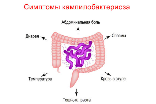 Симптомы кампилобактериоза