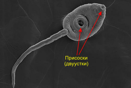 Класс сосальщики