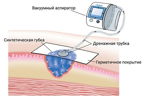 Современные методы лечения