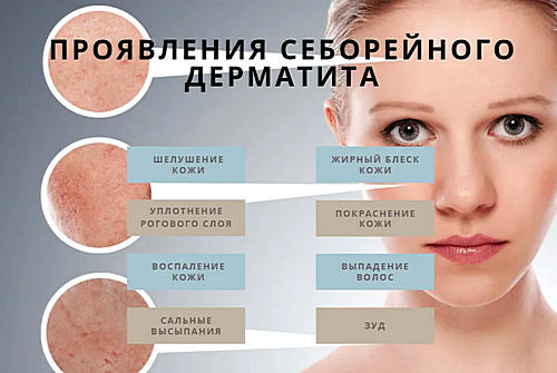 Причины развития СД