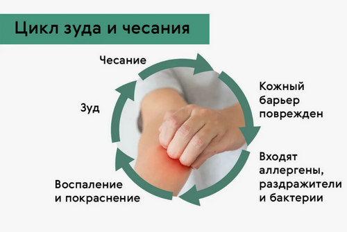 Контактный дерматит - патогенез