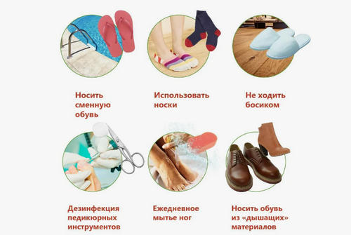 Микоз прогноз и профилактика